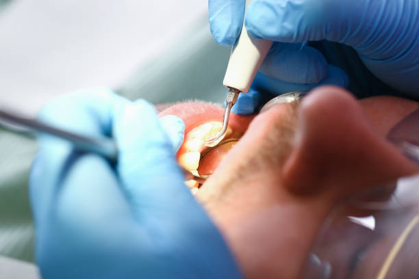 Best Cosmetic Emergency Dentistry in Morton, IL