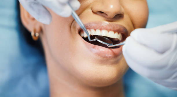 Best Emergency Dental Care for Broken or Chipped Teeth in Morton, IL