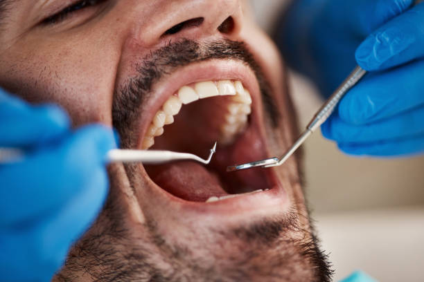 Best Cosmetic Emergency Dentistry in Morton, IL