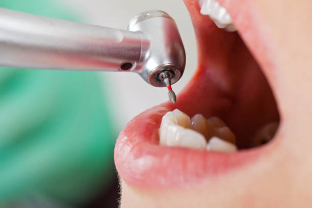 Best Emergency Gum Treatment in Morton, IL